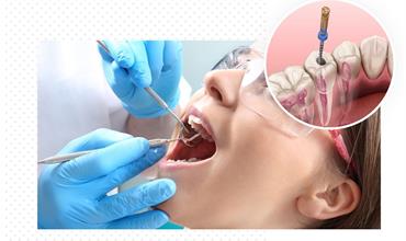 جراحی ریشه دندان چگونه انجام می‌شود؟